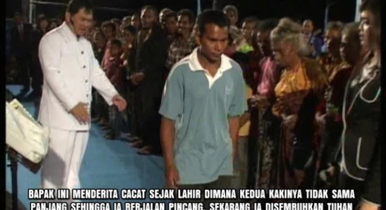 Gallery Kesaksian 44 cacat_lahir_kaki_tdk_sama_panjang