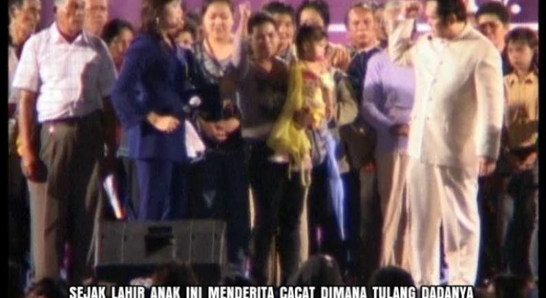 Gallery Kesaksian 45 cacat_lahir_tulang_dada_menonjol_keluar