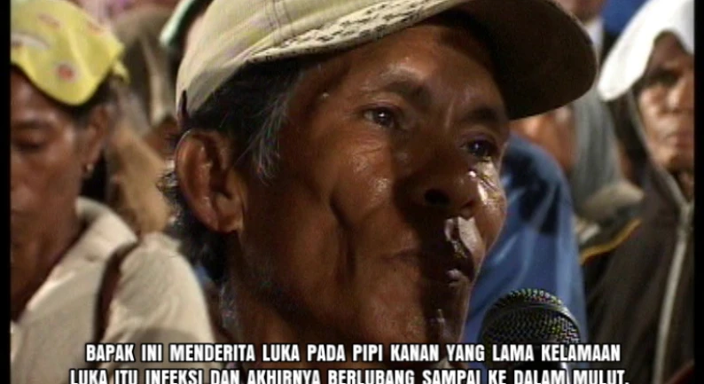 Gallery Kesaksian 80 pipi_lubang_infeksi_disembuhkan