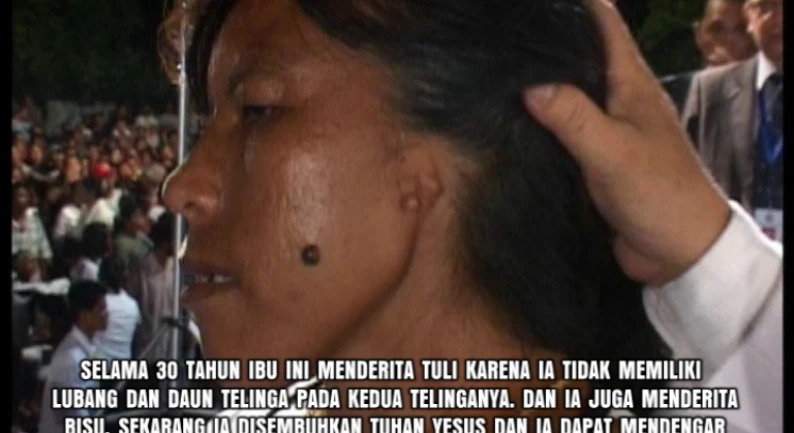Gallery Kesaksian 89 tuli_30_thn_tanpa_lubang_telinga_disembuhkan