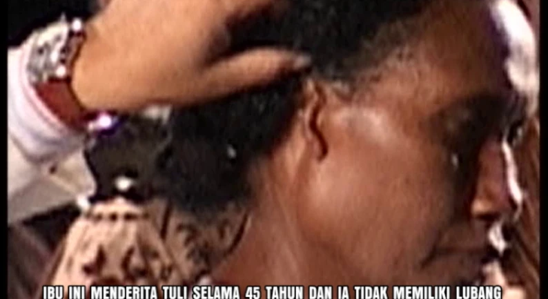 Gallery Kesaksian 91 tuli_45_tahun_tanpa_lubang_telinga_disembuhkan