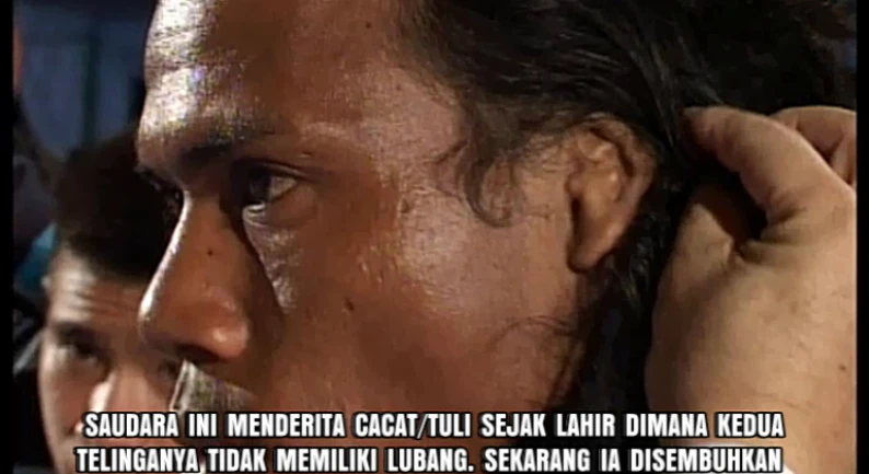 Gallery Kesaksian 96 tuli_sejak_lahir_tanpa_lubang_telinga_disembuhkan
