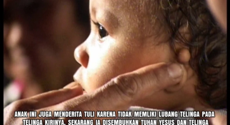 Gallery Kesaksian 98 tuli_tanpa_lubang_telinga_disembuhkan